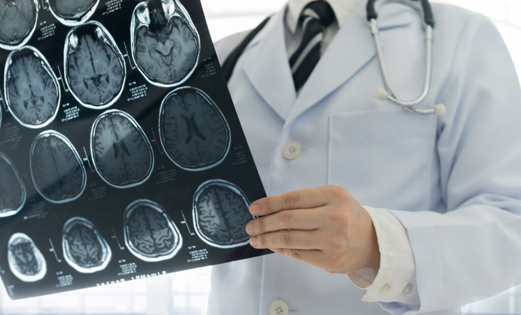 scan of traumatic brain injuries
